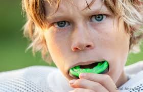 advanced orthodontic center, mouth guard