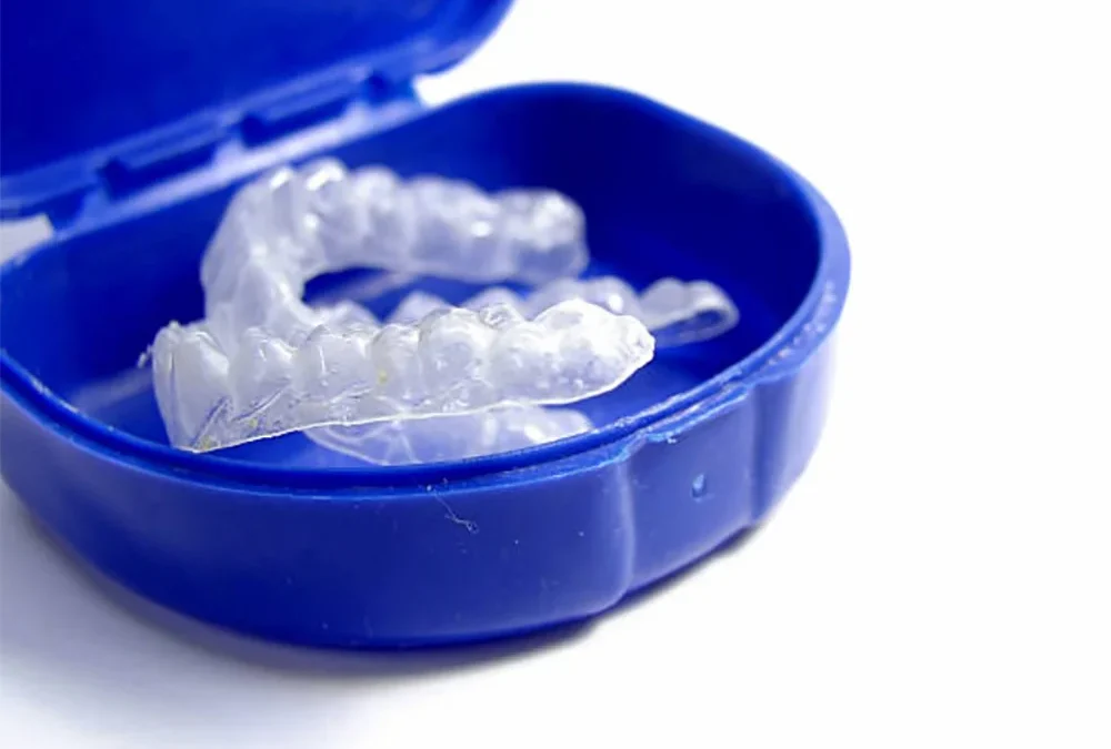 Retainers