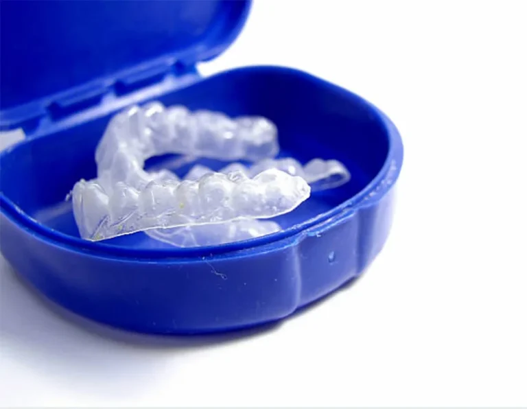 Clear dental retainers in a blue plastic case on a white background.