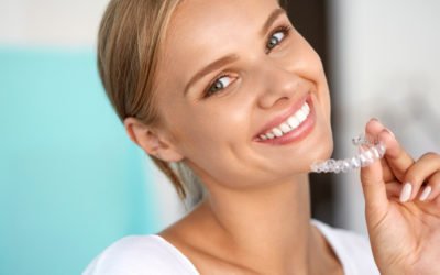 Benefits of Braces You Didn’t Know About