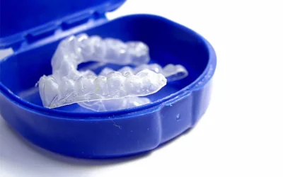 How To Properly Take Care of Your Retainer