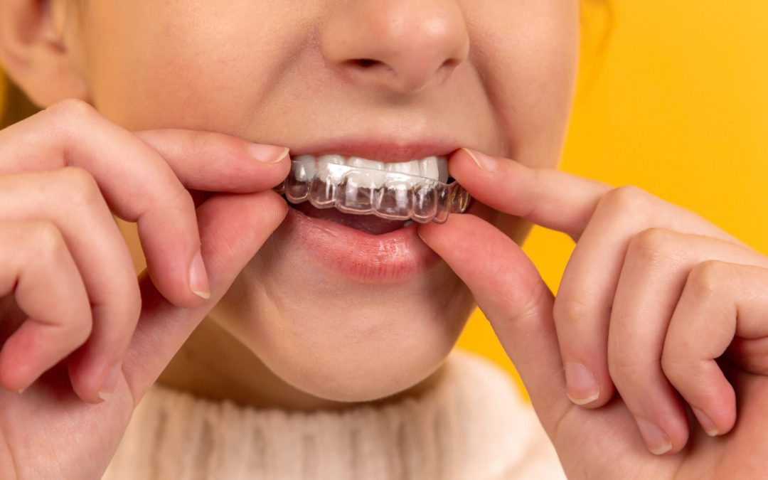 How To Clean Retainers