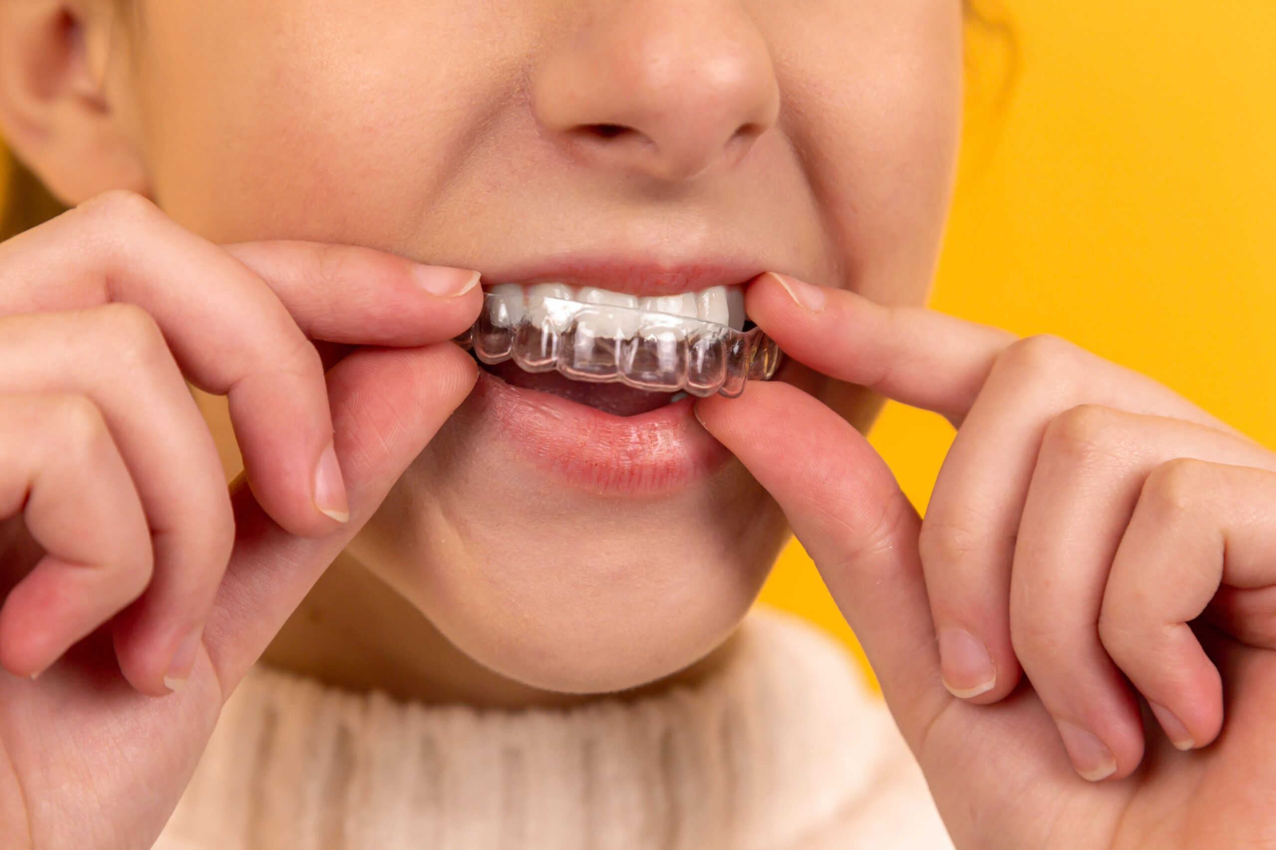 A person placing a clear dental aligner on their teeth against a yellow background.