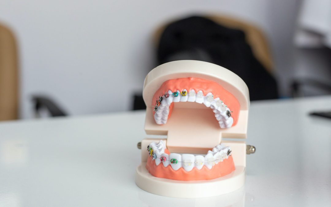 Keep Your Braces Clean With These Tips
