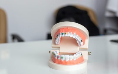 Keep Your Braces Clean With These Tips