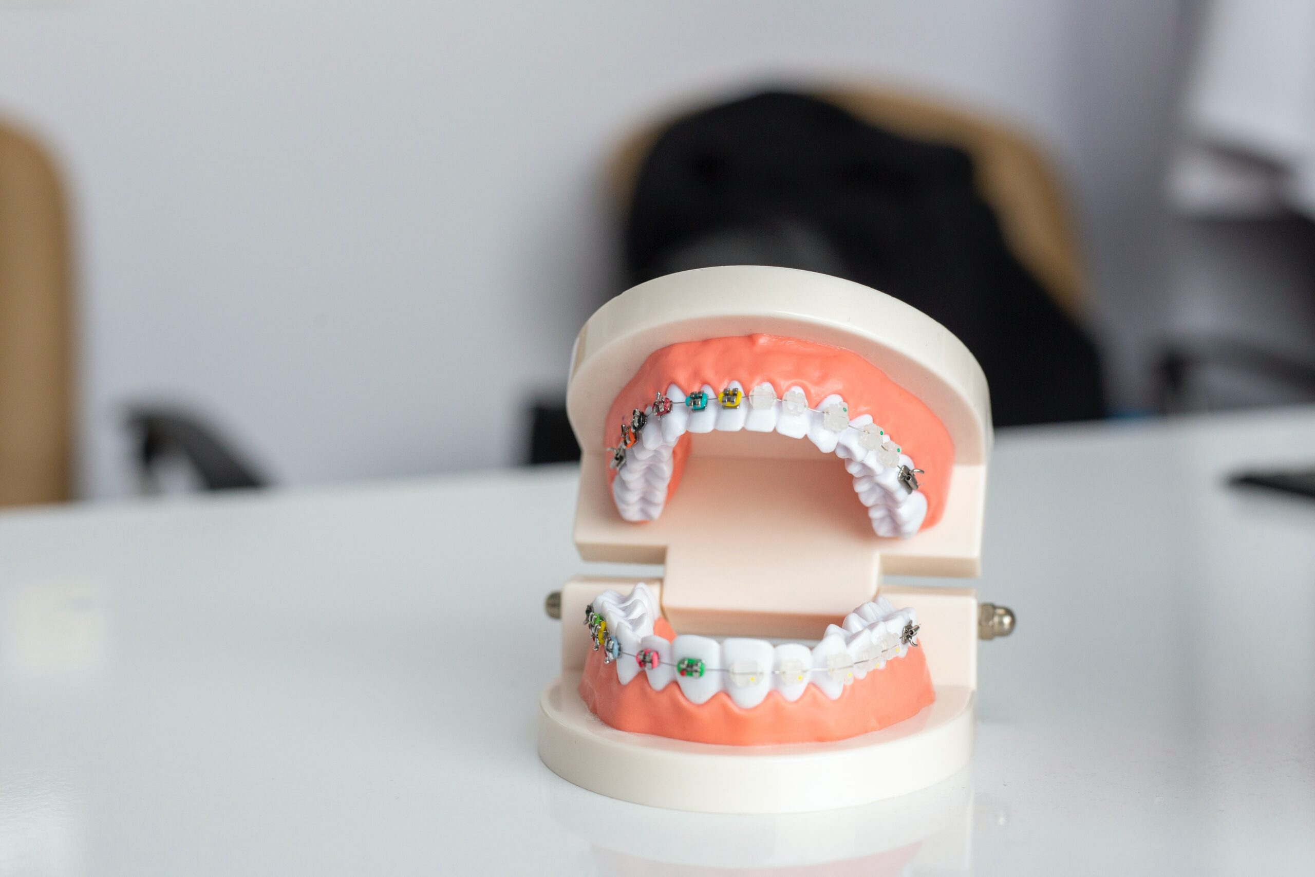 A dental model with braces on its teeth is displayed on a white table.