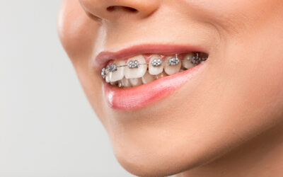 Orthodontic Care for Every Age: Embracing Braces