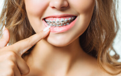 Orthodontics: Beyond Aesthetics to Dental Health and Wellness