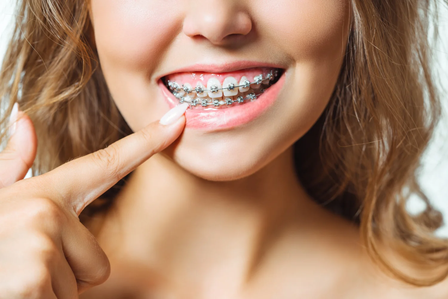 Orthodontics: Beyond Aesthetics to Dental Health and Wellness - Advanced Orthodontic Center | Mission Viejo, California
