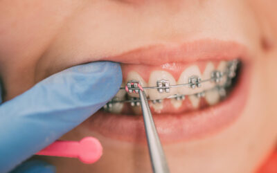 Orthodontic Care Beyond Braces: Comprehensive Approaches to Oral Health