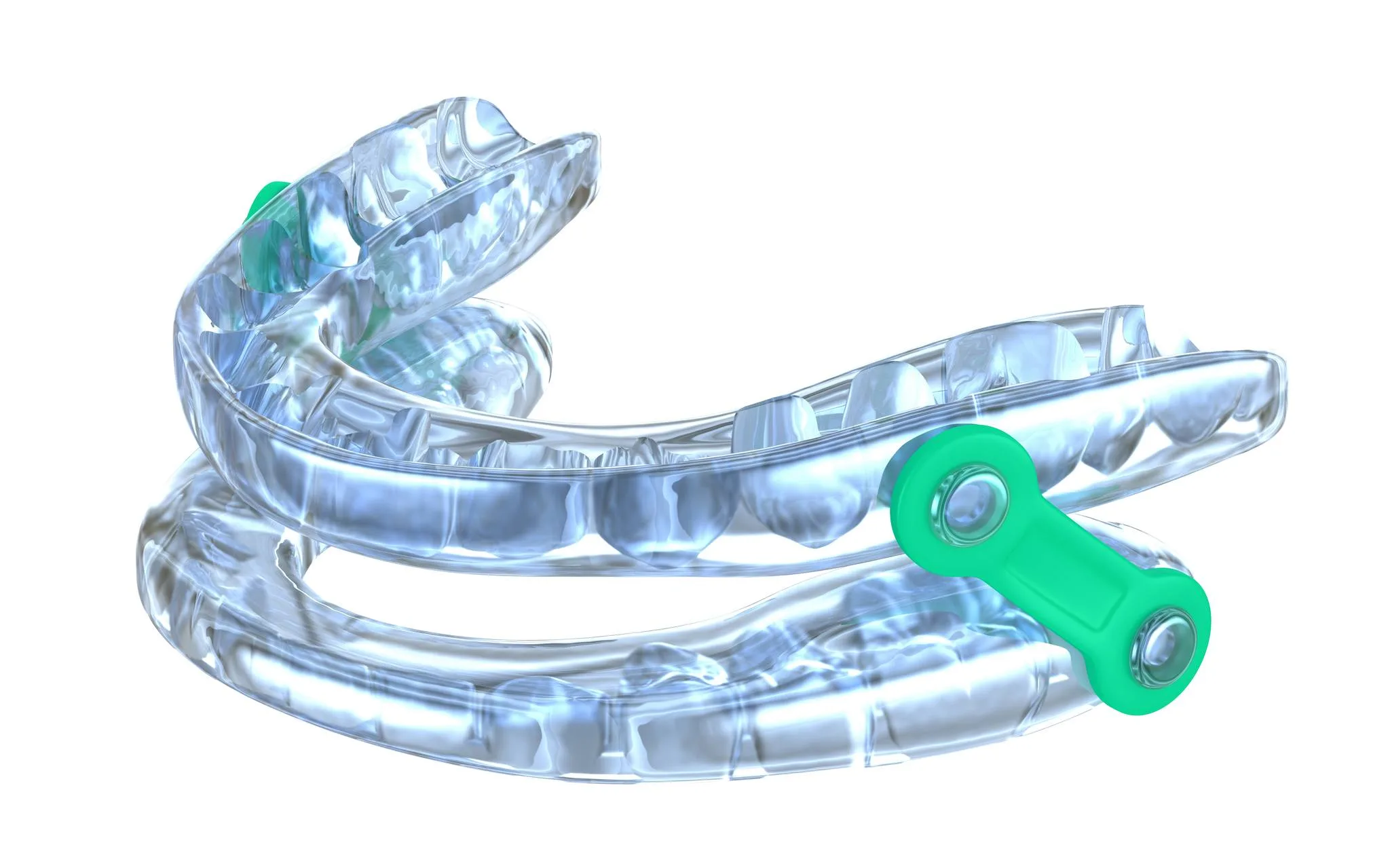 Clear dental mouthguard with green adjustable hinges, designed for orthodontic or sleep apnea treatment, on white background.