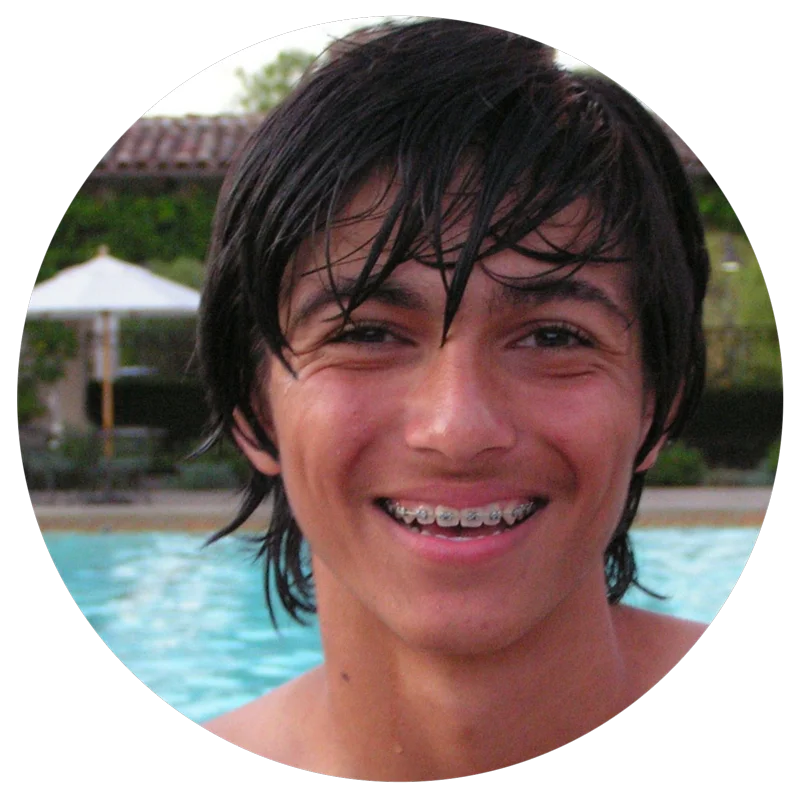 Smiling teenager with wet hair and braces, standing in front of a swimming pool outdoors.