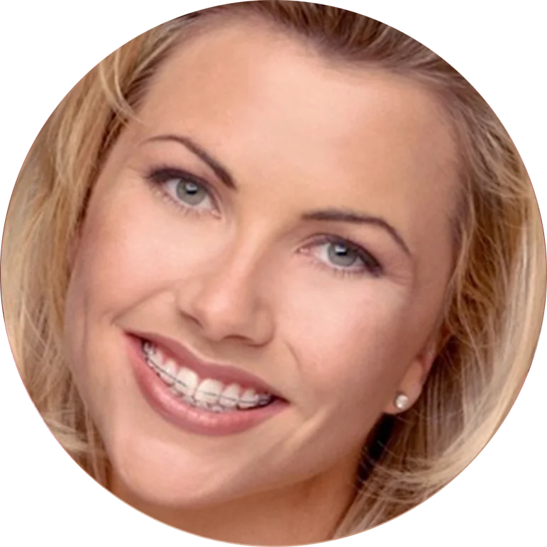 Smiling woman with blonde hair and clear braces, wearing pearl earrings, facing the camera.