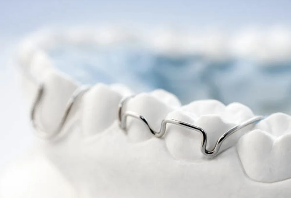 Close-up of a dental model showing orthodontic wire attached to white artificial teeth.