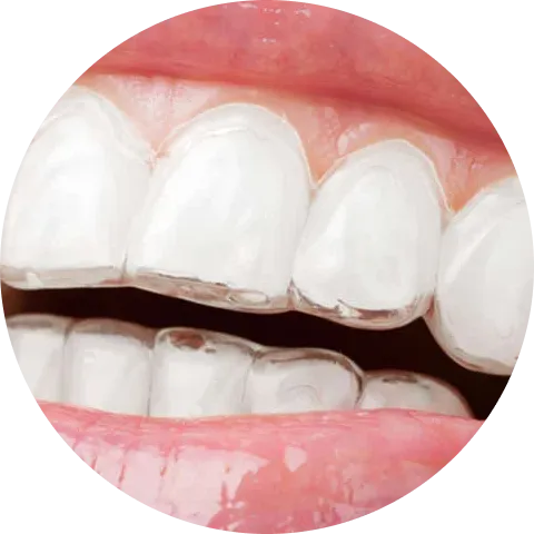 Close-up of a person's clean, white teeth and pink lips, shown in a circular frame.