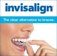 invisalign16-1