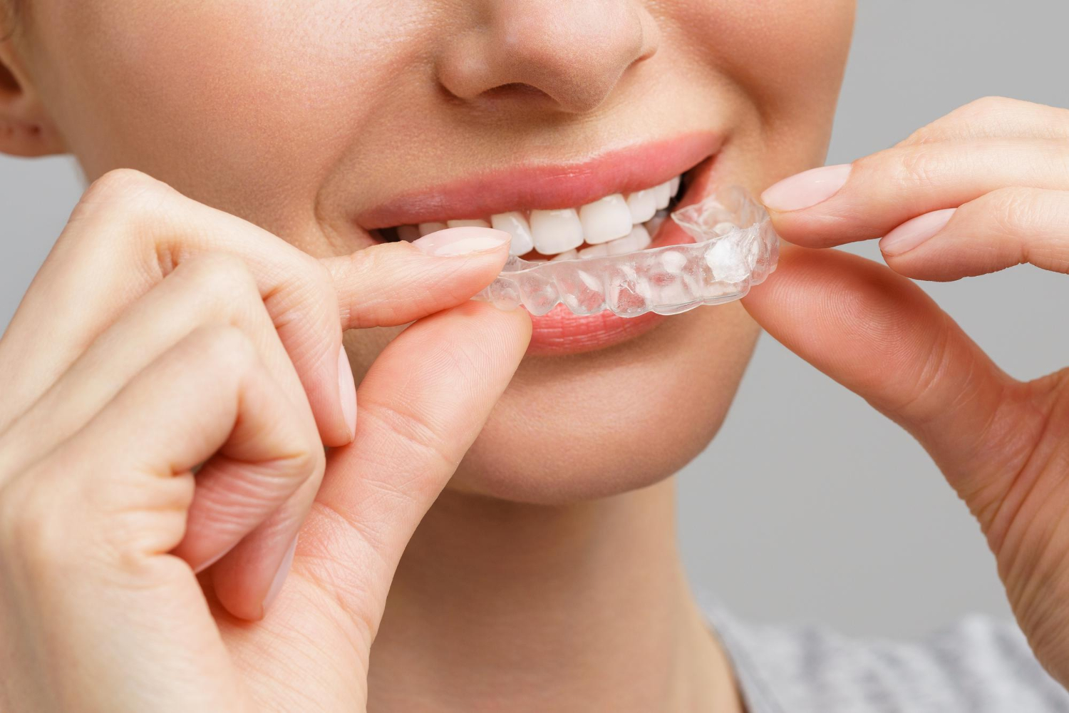 Person smiling while putting a clear dental aligner on their upper teeth.