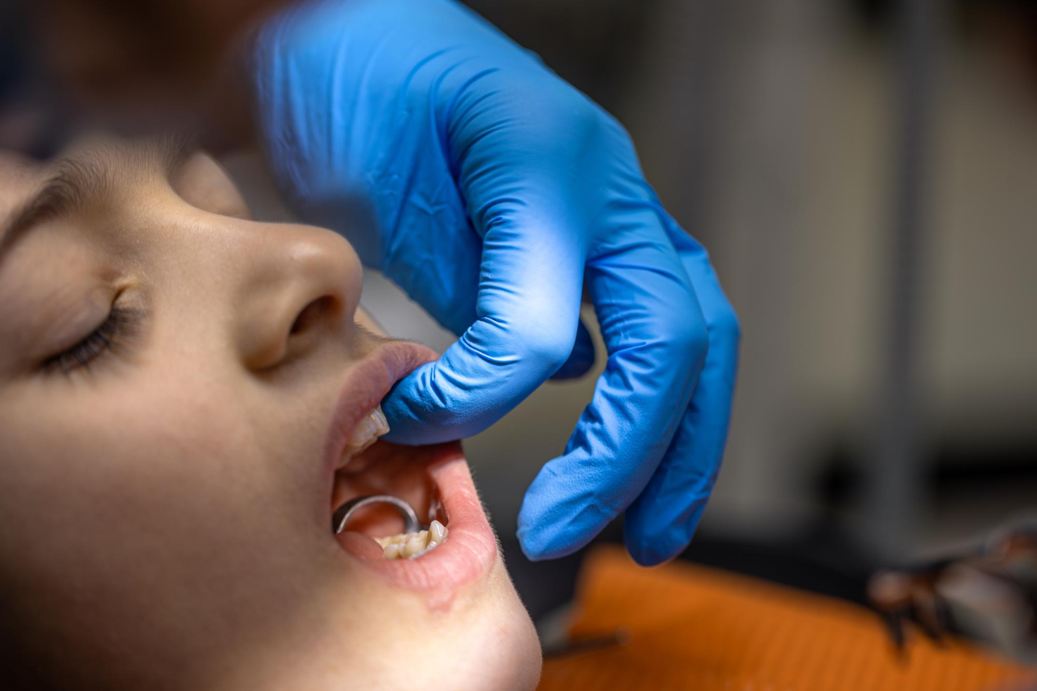 A dentist wearing blue gloves checks a child’s teeth with braces in a dental clinic.